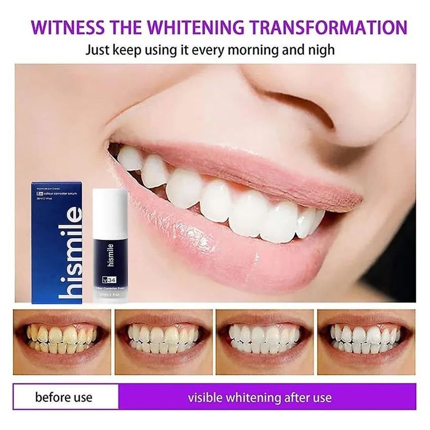 Hismile-Sérum de dentifrice V34, 8 pièces, tons jaunes, augmente la luminosité des dents, filtré